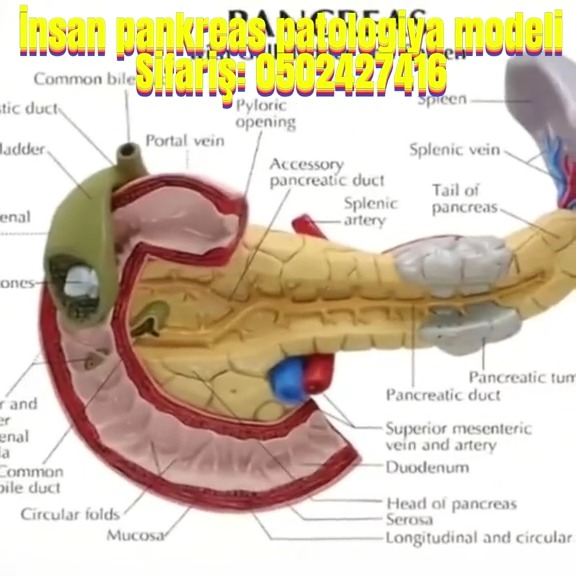 İnsan pankreas patologiyası modeli - Tenderyard